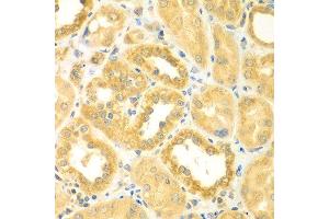 Immunohistochemistry of paraffin-embedded human kidney using PDE4DIP antibody at dilution of 1:100 (40x lens).
