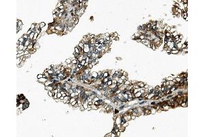 IHC analysis of Rex1/ZFP42 using anti-Rex1/ZFP42 antibody (ABIN7600901).