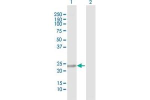 Western Blot analysis of C9orf95 expression in transfected 293T cell line by C9orf95 MaxPab polyclonal antibody.