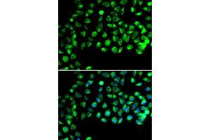 Immunofluorescence analysis of A549 cells using C16orf80 antibody. (C16orf80 Antikörper  (AA 1-193))