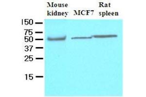 Cell lysates of mouse kidney, MCF7 and rat spleen (40 ug) were resolved by SDS-PAGE, transferred to nitrocellulose membrane and probed with anti-human FLIP (1:500). (FLIP Antikörper  (AA 1-376))
