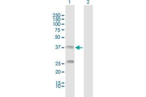 Western Blot analysis of C4BPB expression in transfected 293T cell line by C4BPB MaxPab polyclonal antibody. (C4BPB Antikörper  (AA 1-252))