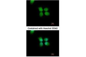 ICC/IF Image Immunofluorescence analysis of paraformaldehyde-fixed A431, using ORC4L, antibody at 1:500 dilution. (ORC4 Antikörper  (C-Term))