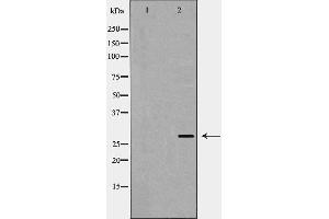 Western blot analysis of VEGF expression in A431 cells,The lane on the left is treated with the antigen-specific peptide. (VEGFA Antikörper  (Internal Region))