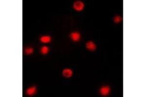 Immunofluorescent analysis of C/EBP zeta staining in COLO205 cells. (DDIT3 Antikörper  (N-Term))