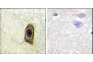 Immunohistochemical analysis of paraffin-embedded human brain, using CSFR (Phospho-Tyr561) antibody (left)or the same antibody preincubated with blocking peptide (right). (CSF1R Antikörper  (pTyr561))