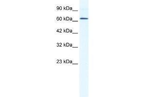 DDX21 antibody used at 1. (DDX21 Antikörper)