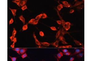 Immunofluorescence analysis of NIH-3T3 cells using ADAMTS13 Polyclonal Antibody at dilution of 1:100 (40x lens). (ADAMTS13 Antikörper)