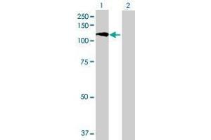 Western Blotting (WB) image for KIAA1199 293T Cell Transient Overexpression Lysate(Denatured) (ABIN1337203)