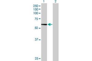 Western Blot analysis of HEXB expression in transfected 293T cell line by HEXB MaxPab polyclonal antibody. (HEXB Antikörper  (AA 1-556))