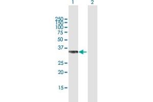 Western Blotting (WB) image for anti-Protein Phosphatase 2, Catalytic Subunit, beta Isozyme (PPP2CB) (AA 1-309) antibody (ABIN948302)