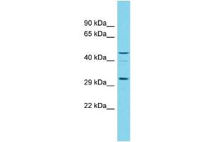 Host:  Rabbit  Target Name:  RGD1305007  Sample Type:  Rat Testis lysates  Antibody Dilution:  1. (OGFOD3 Antikörper  (N-Term))