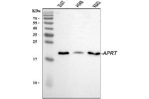 Western blot analysis of APRT using anti-APRT antibody (ABIN4886471).