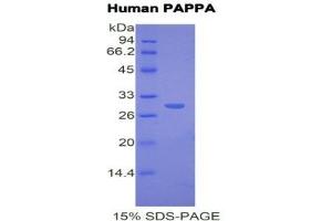 SDS-PAGE (SDS) image for Pregnancy-Associated Plasma Protein A, Pappalysin 1 (PAPPA) (AA 317-532) protein (His tag) (ABIN1171177)