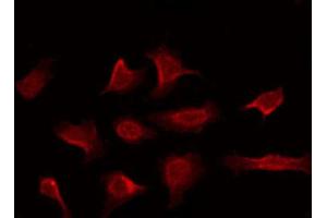 ABIN6269296 staining NIH-3T3 by IF/ICC. (14-3-3 zeta Antikörper  (C-Term))