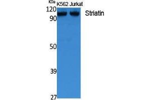 Western Blotting (WB) image for anti-Striatin (STRN) (C-Term) antibody (ABIN3178123) (Striatin Antikörper  (C-Term))