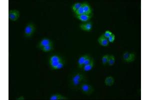 Immunofluorescence staining of HepG2 cells with ABIN7127445 at 1:76, counter-stained with DAPI.
