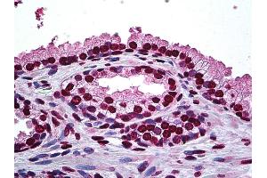 Anti-DLX2 antibody IHC of human prostate. (DLX2 Antikörper  (AA 1-110))
