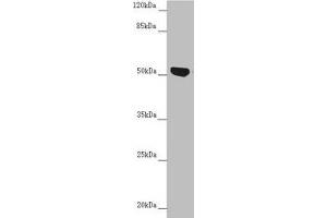 Western blot All lanes: NUF2 antibody at 5. (NUF2 Antikörper  (AA 165-464))