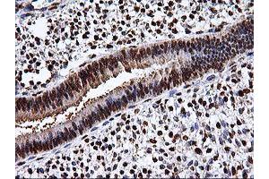 Image no. 9 for anti-EPM2A (Laforin) Interacting Protein 1 (EPM2AIP1) antibody (ABIN1498046) (EPM2AIP1 Antikörper)