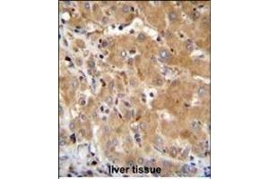 GGH Antibody (N-term) (ABIN655183 and ABIN2844798) immunohistochemistry analysis in formalin fixed and paraffin embedded human liver tissue followed by peroxidase conjugation of the secondary antibody and DAB staining. (GGH Antikörper  (N-Term))