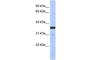 WB Suggested Anti-ESD Antibody Titration: 0. (Esterase D Antikörper  (N-Term))
