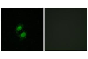 Immunofluorescence analysis of A549 cells, using ZNF95 antibody.