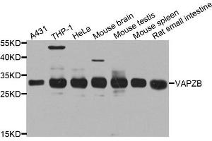 Western blot analysis of extract of various cells, using CAPZB antibody. (CAPZB Antikörper)