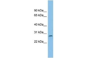 WB Suggested Anti-C1orf104 Antibody Titration: 0. (C1orf104 Antikörper  (Middle Region))