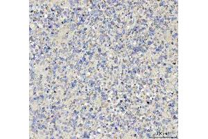 IHC analysis of TNR using anti-TNR antibody (ABIN4886752).