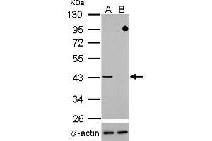 WB Image Western blot analysis of TDP-43 (, upper panel) and beta-actin , lower panel)  Sample (30 ug of whole cell lysate)   A: HeLa mock control  B: HeLa transfected shTDP-43 10% SDS PAGE  antibody diluted at 1:500 (TARDBP Antikörper)