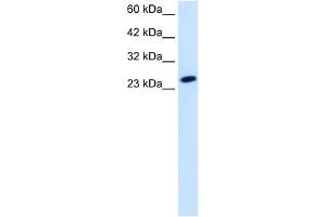 WB Suggested Anti-TBPL1 Antibody Titration:  1. (TBPL1 Antikörper  (Middle Region))