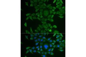 Immunofluorescence analysis of U2OS cells using CCBL1 Polyclonal Antibody (CCBL1 Antikörper)
