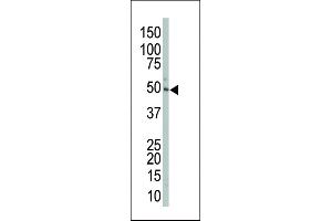 The anti-P2K2 Pab (ABIN392485 and ABIN2842062) is used in Western blot to detect P2K2 in mouse liver tissue lysate. (MEK2 Antikörper  (AA 262-292))