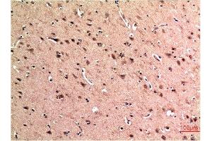Immunohistochemical analysis of paraffin-embedded Human Brain Tissue using Beclin-1 Mouse mAb diluted at 1:200. (Beclin 1 Antikörper)