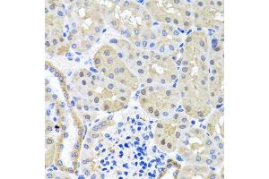 Immunohistochemistry of paraffin-embedded mouse kidney using BSND antibody.