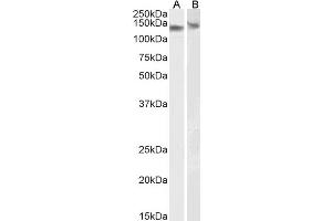 DDB1 Antikörper  (C-Term)