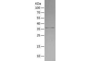 Western Blotting (WB) image for Doublecortin (DCX) (AA 107-208) protein (His-IF2DI Tag) (ABIN7122702) (Doublecortin Protein (DCX) (AA 107-208) (His-IF2DI Tag))