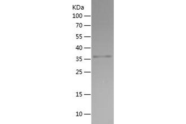 Doublecortin Protein (DCX) (AA 107-208) (His-IF2DI Tag)
