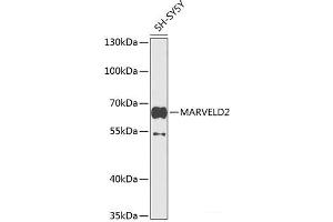 Western blot analysis of extracts of SH-SY5Y cells using MARVELD2 Polyclonal Antibody at dilution of 1:1000. (Tricellulin Antikörper)