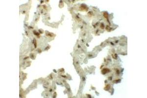 Immunohistochemistry (IHC) image for anti-Transmembrane 4 L Six Family Member 1 (TM4SF1) (N-Term) antibody (ABIN1031625) (TM4SF1 Antikörper  (N-Term))