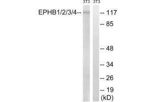 Western blot analysis of extracts from 3T3 cells, treated with heat shock, using EPHB1/2/3/4 (Ab-600/602/614/596) antibody. (Ephb1+Ephb2+Ephb3+Ephb4 (Tyr596), (Tyr600), (Tyr602), (Tyr614) Antikörper)