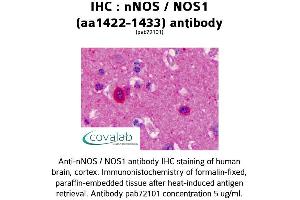 Image no. 1 for anti-Nitric Oxide Synthase 1, Neuronal (NOS1) (AA 1422-1433) antibody (ABIN5693644) (NOS1 Antikörper  (AA 1422-1433))