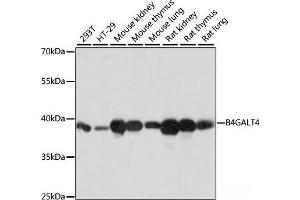 Western blot analysis of extracts of various cell lines using B4GALT4 Polyclonal Antibody at dilution of 1:1000. (B4GALT4 Antikörper)