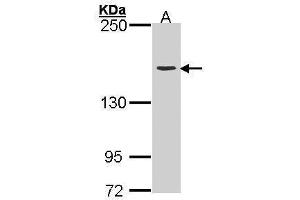WB Image Sample (30 ug of whole cell lysate) A: H1299 5% SDS PAGE antibody diluted at 1:3000 (Topoisomerase II alpha Antikörper  (C-Term))