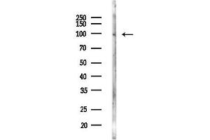 Western blot analysis of lysates from Hela cells(LPS,4h treatment), using PDE6C Antibody at 1/1000 dilution.