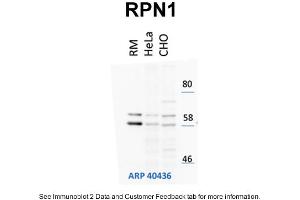 WB Suggested Anti-RPN1 Antibody Titration: 1 µg/mL Positive Control: HeLa and CHO-K1 cell lines, rouch canine microsomes