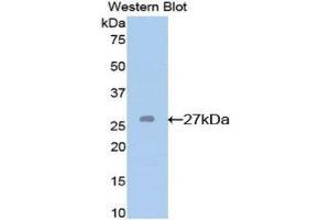 Western Blotting (WB) image for anti-Glutathione S-Transferase mu 2 (Muscle) (GSTM2) (AA 1-218) antibody (ABIN1078085)
