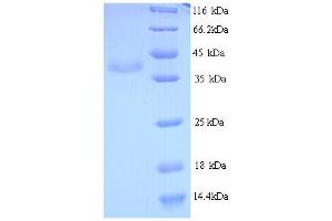 SDS-PAGE (SDS) image for VP2 (AA 2-351) protein (His tag) (ABIN5714200) (VP2 (AA 2-351) protein (His tag))