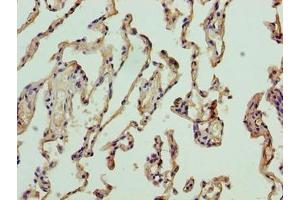 Immunohistochemistry of paraffin-embedded human lung tissue using ABIN7161563 at dilution of 1:100 (NICN1 Antikörper  (AA 1-213))
